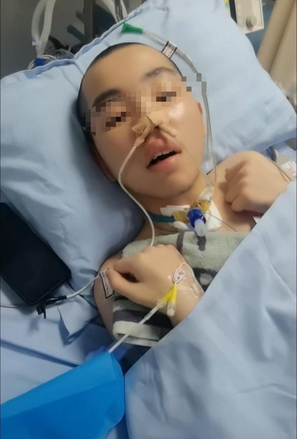 联华证券 14岁男生嬉闹时被女同学打中左胸后瘫痪 家属: 女孩父母为残疾人, 后续费用无着落